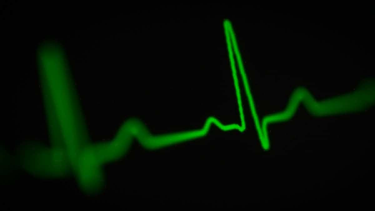 Applicazione libera per tracciare la pressione arteriosa